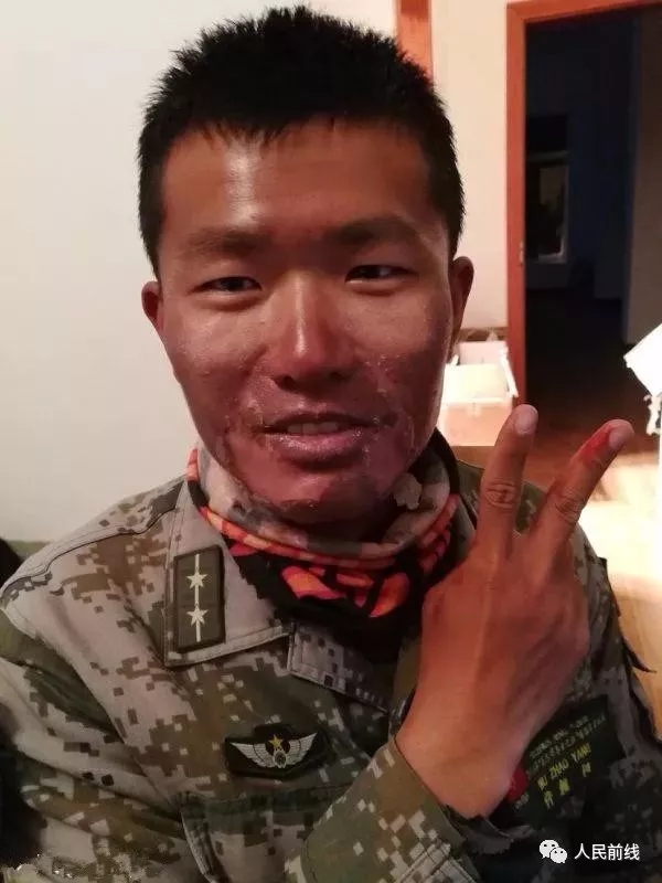 印刻在龟裂,脱皮的脸庞上