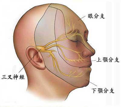 军医科普:三叉神经痛应该怎样治疗