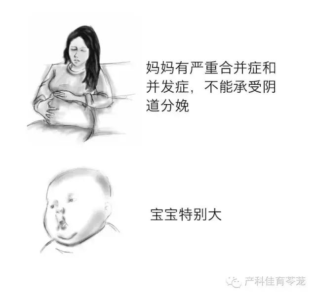 军医科普:顺产还是剖宫产,如何取舍?