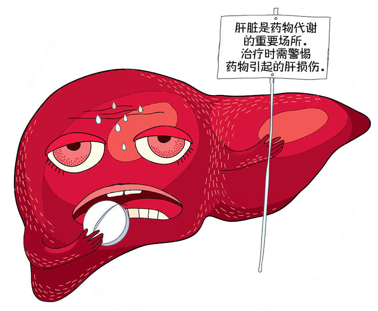 中国人“爱吃药” 警惕吃出药物性肝损伤