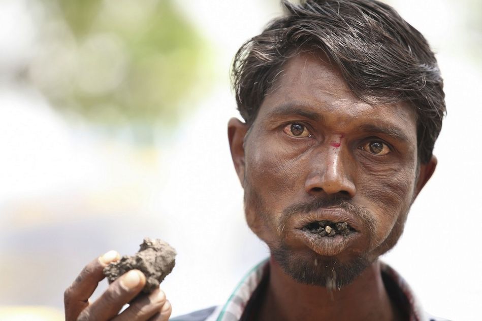 印度异食癖男子吃砖头上瘾近20年组图