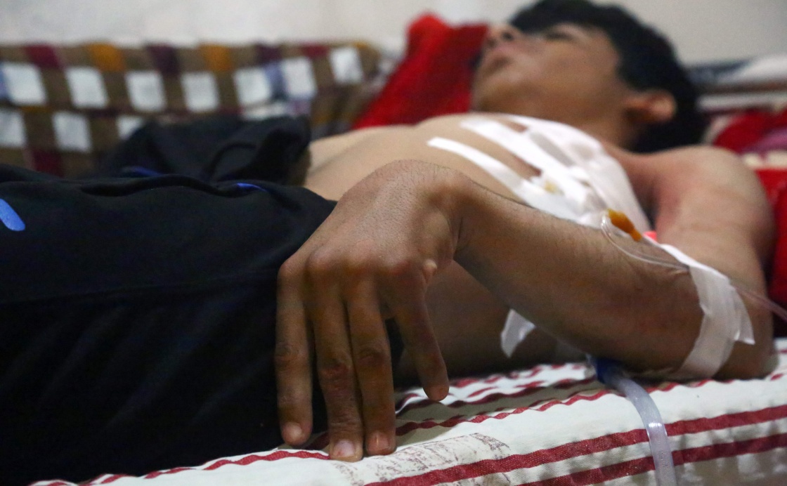 5月2日,在叙利亚哈塞克,一名受伤男子在医院接受治疗.新华社/法新