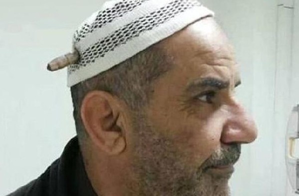 伊大叔被子弹爆头竟没啥事