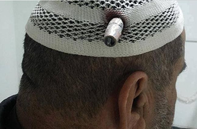 伊大叔被子弹爆头竟没啥事