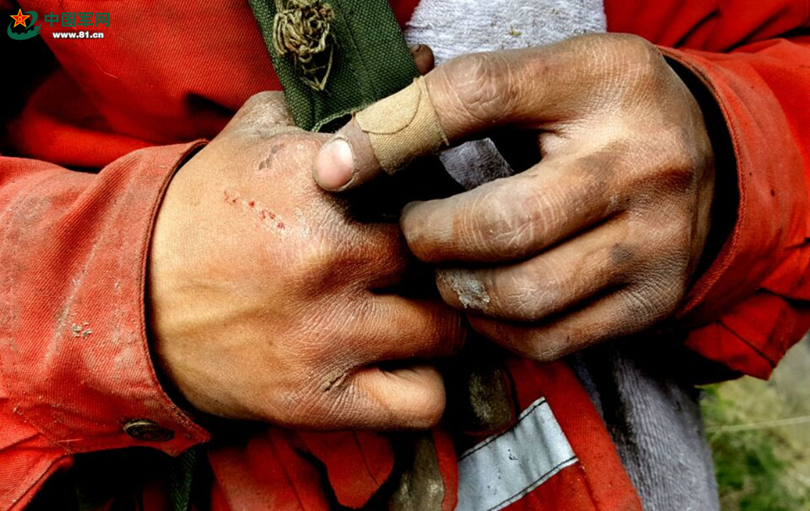 "伤疤记忆"丨你不曾提起的那些"印记"有着怎样的故事?