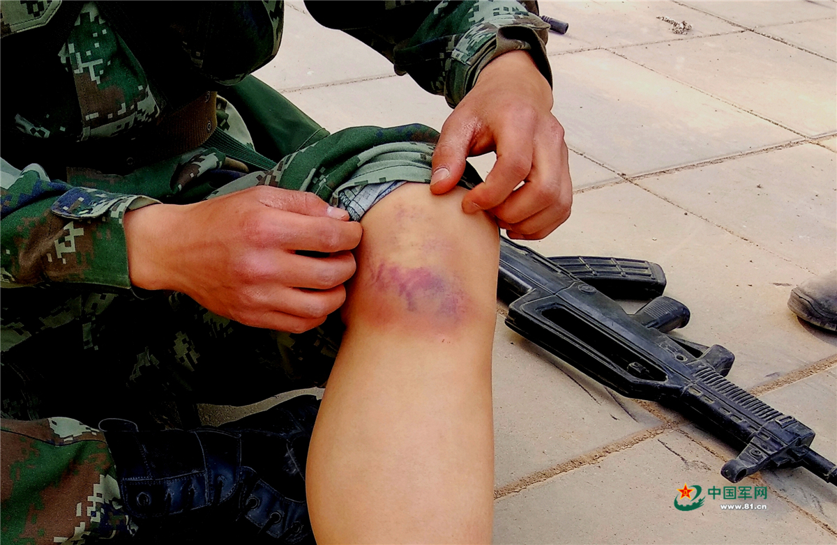 第一枚:英勇无畏的"军功章"