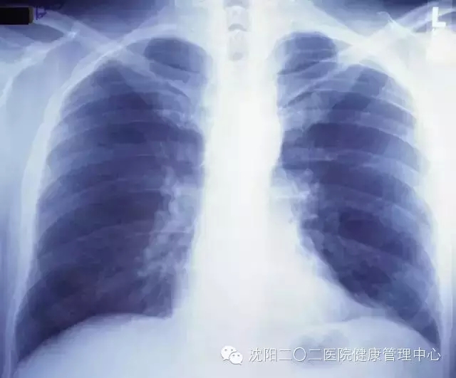 x光什么频率如何选择X光片、CT和磁共振检查-上海聚慕医疗器械有限公司