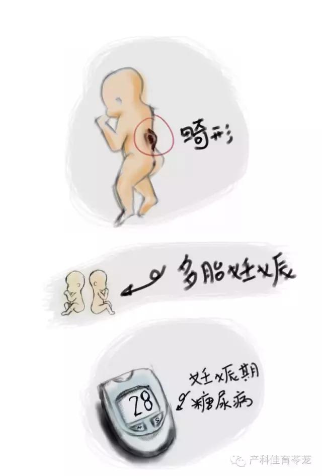 军医科普关于羊水的那些事儿