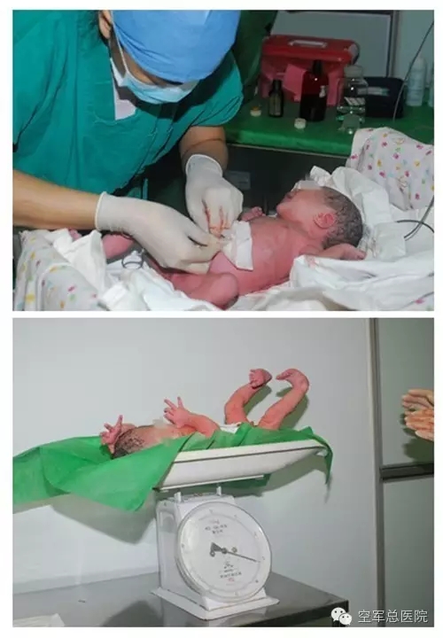 老照片的故事空军总医院第一例试管婴儿诞生